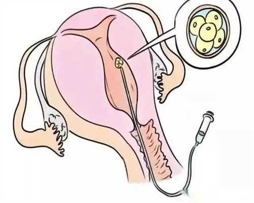 安徽借卵价格,安徽试管婴儿纳入医保是真的吗附2026三代试管*男孩收费标准