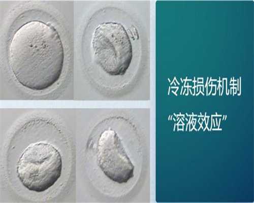 移植后平躺可不可以屈腿？移植第一天平躺腿能不能弯起来？*助孕公司